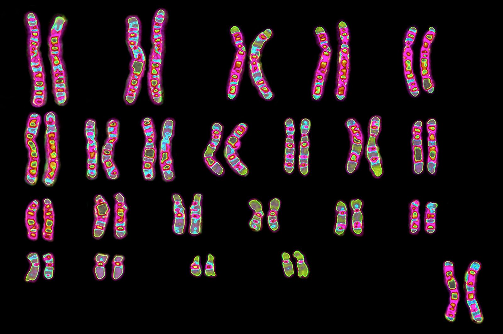 Cromosomas humanos